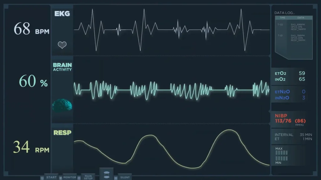 Anomaly Detection